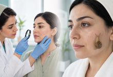 فواید وعوارض حلزون تراپی